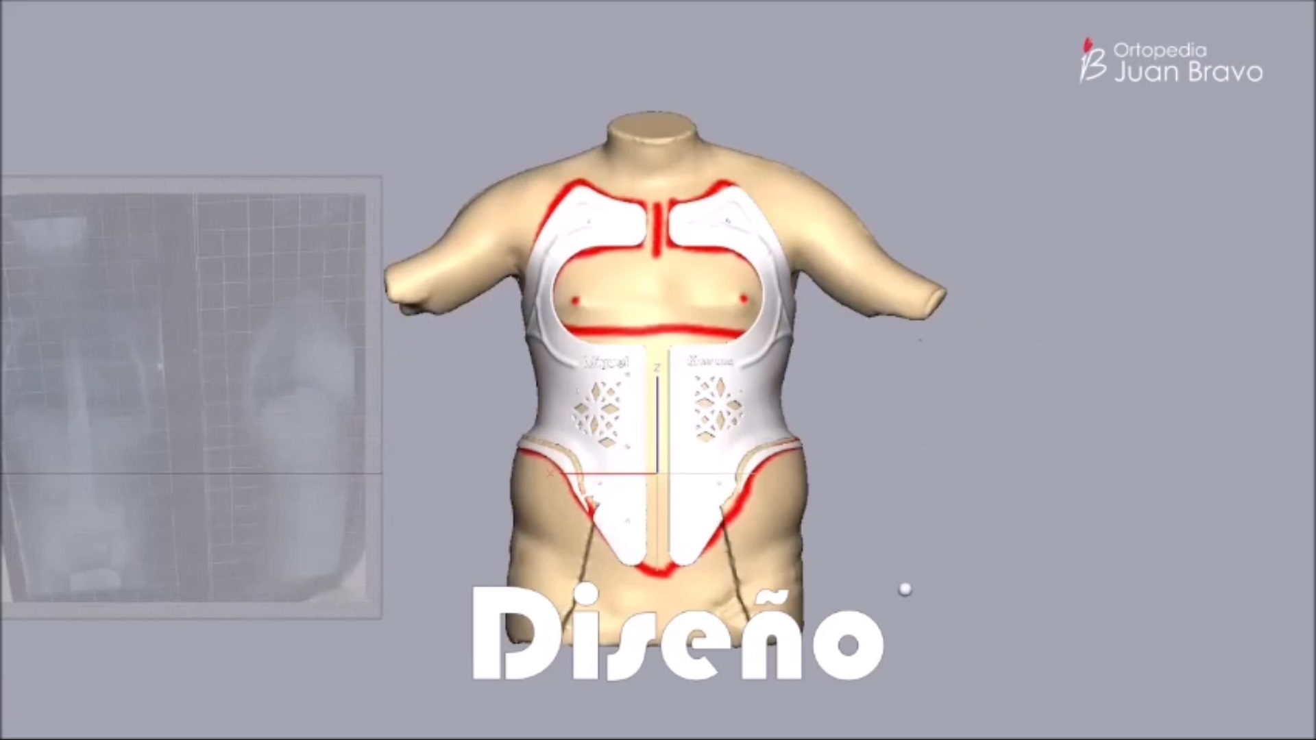 Diseño del corse 3D