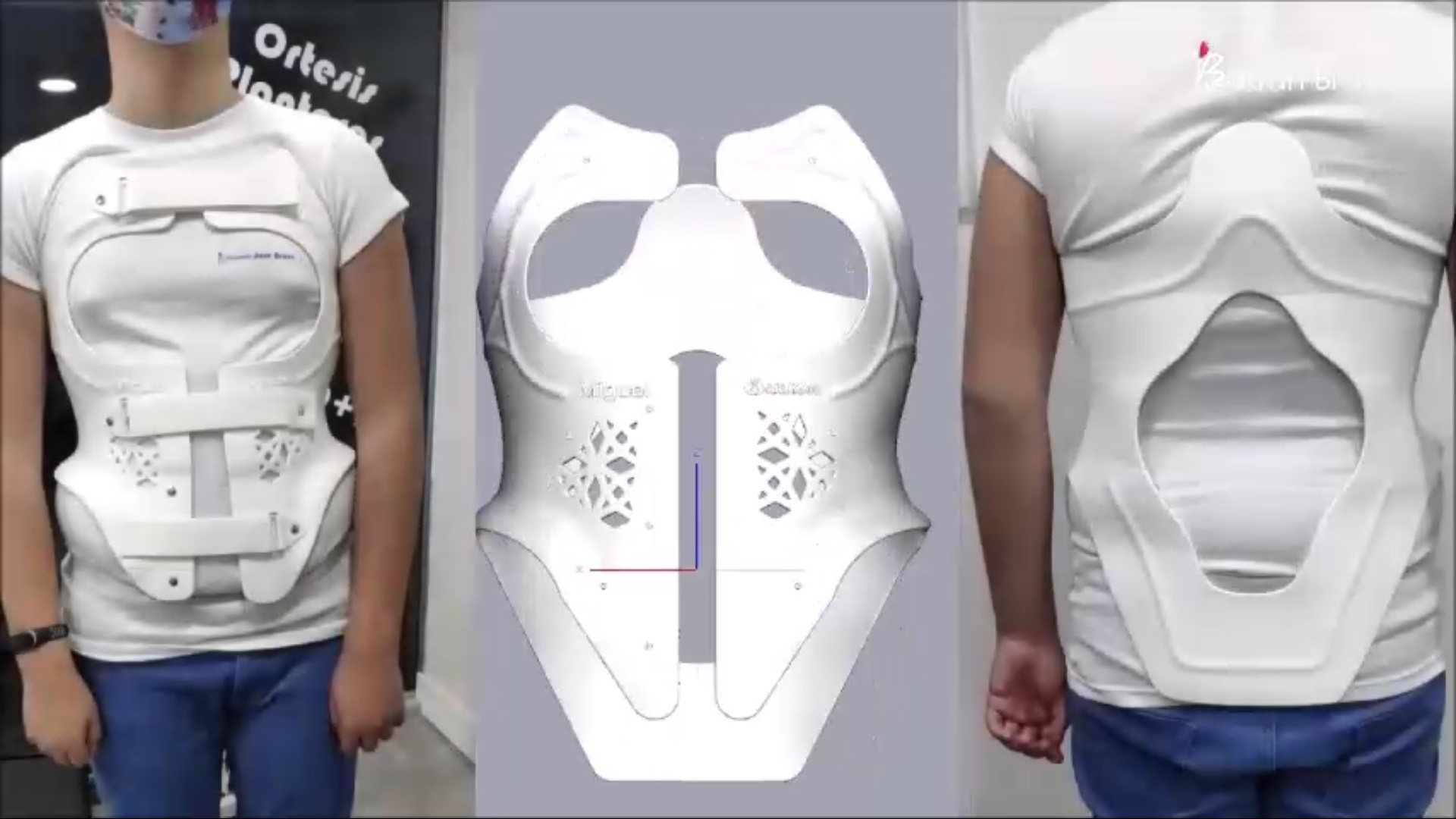 Prueba final en paciente del corse 3D