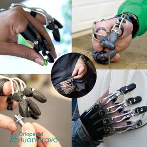 Protesis funcionales ortopedia tecnica
