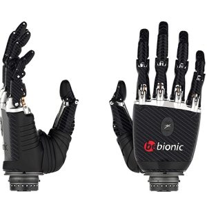 Protesis de mano bionica - ortopedia tecnica